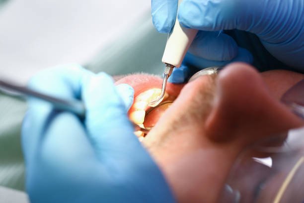 Best Walk-In Emergency Dentist in Avoca, PA