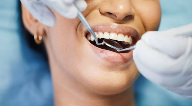 Best Emergency Tooth Extraction in Avoca, PA