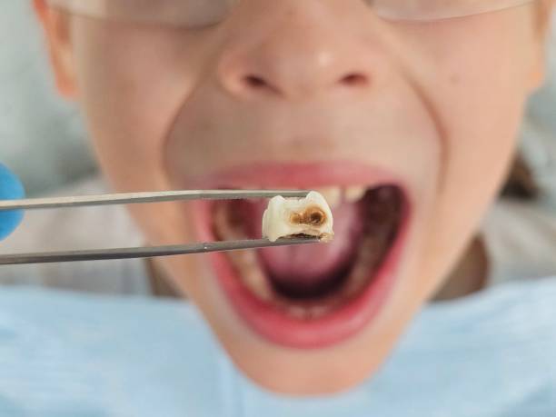 Best Emergency Orthodontic Repairs in Avoca, PA